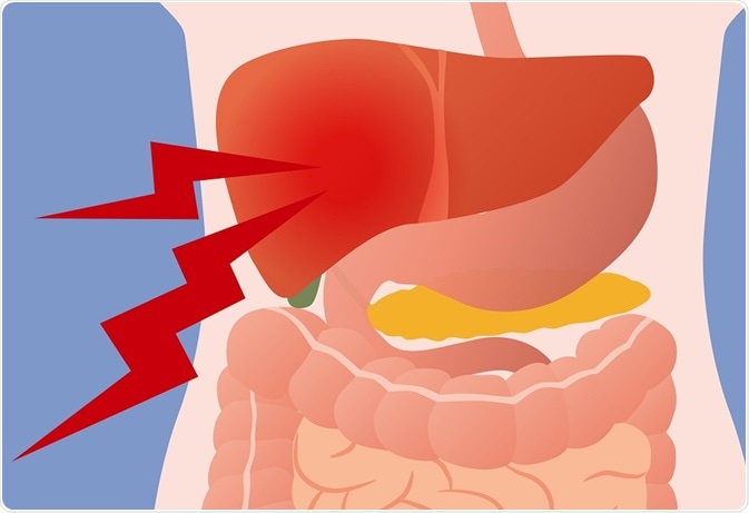 Pain in liver, coming from gallbladder - metamorworks