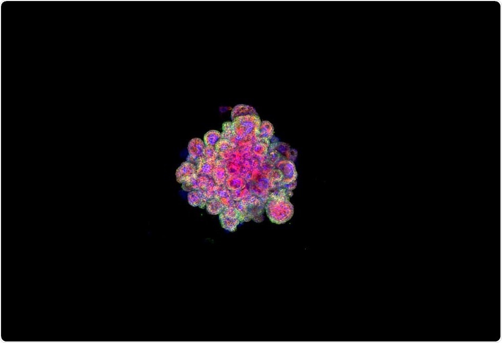 This is a confocal image of a trophoblast organoid stained for cytokeratin 7, F-actin and Dapi. This is a confocal image of a trophoblast organoid stained for cytokeratin 7, F-actin and Dapi.