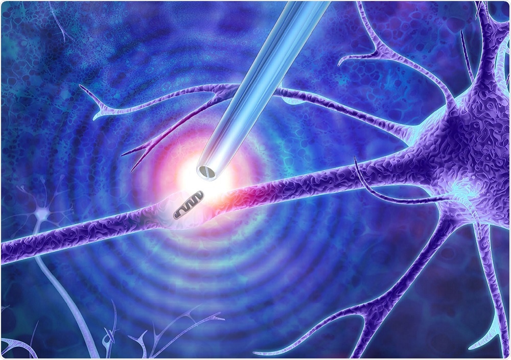 Nanoscale tweezers removing the mitochondria of a cell