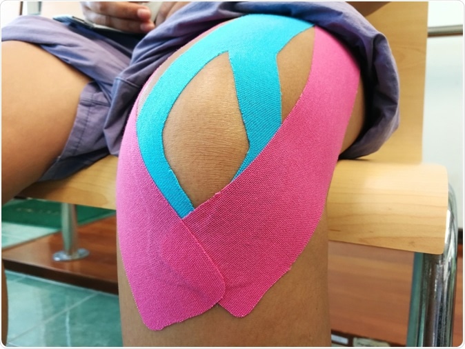 Taping for ACL tear. Image Credit: Piyada Jaiaree