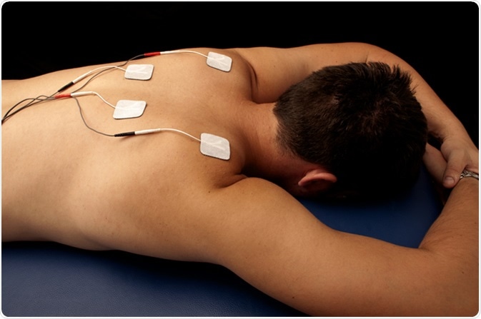 Transcutaneous electrical nerve stimulation (TENS) therapy. Image Credit: DreamBig / Shutterstock