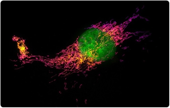 Stochastic Optical Reconstruction Microscopy (STORM)
