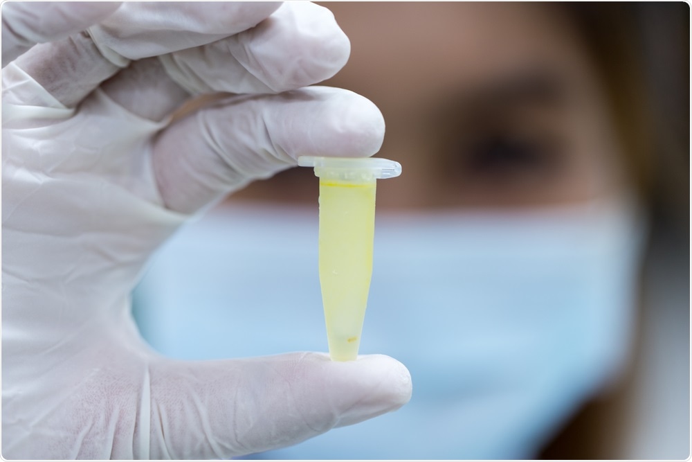 Scientists holding sample of DNA in buffer