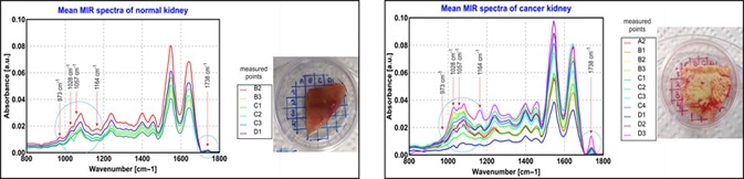 ATR-spectra of kidney & ex-vivo samples