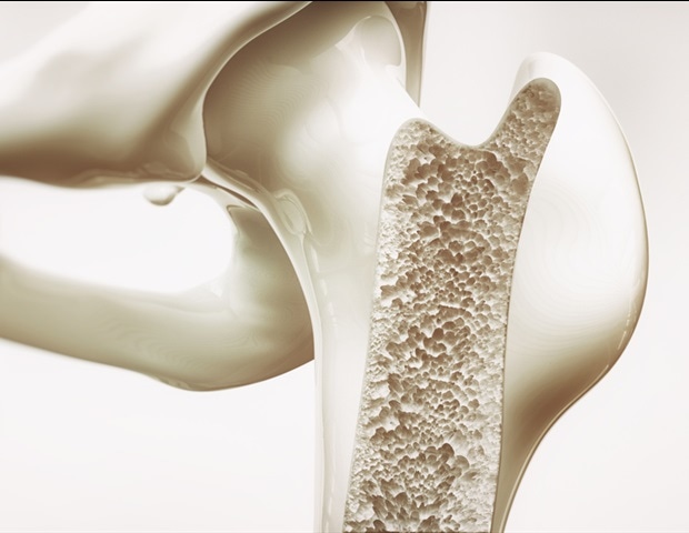 UTSA scientists study osteoporotic bone fractures to rethink treatment