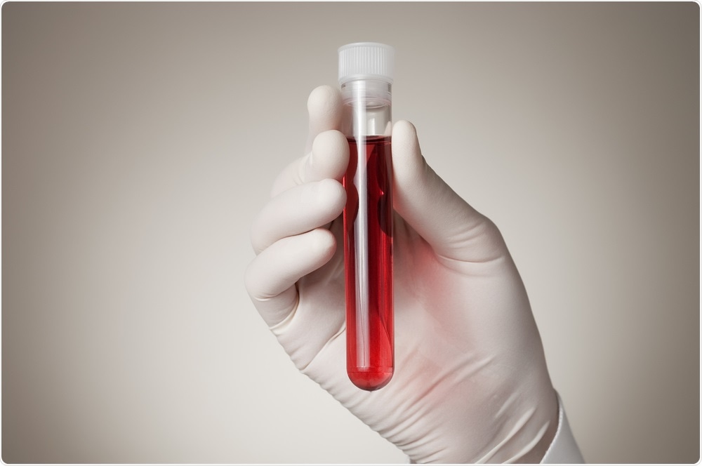 Biomarker blood test Biomarker blood test