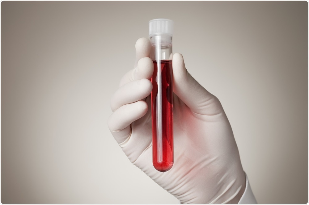 Biomarker blood test