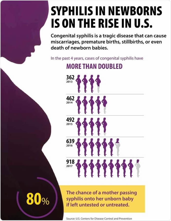 Syphilis in Newborns is on the Rise