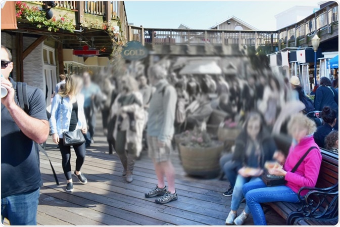 Macular degeneration (AMD or ARMD)- is a medical condition which may result in blurred or no vision in the center of the visual field. Image Credit: Tunatura / Shutterstock Macular degeneration (AMD or ARMD)- is a medical condition which may result in blurred or no vision in the center of the visual field. Image Credit: Tunatura / Shutterstock