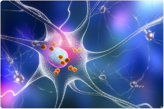 Parkinson's disease. 3D illustration showing neurons containing Lewy bodies small red spheres which are deposits of proteins accumulated in brain cells that cause their progressive degeneration. Image Credit: Kateryna Kon / Shuttertock