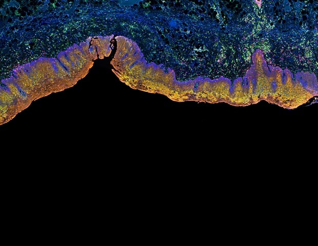 Study describes a molecular strategy that helps prevent development of tumors in mice