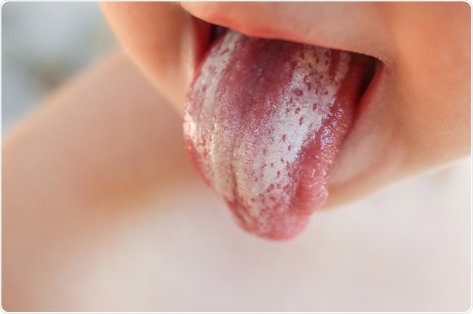 Image result for Tongue baby