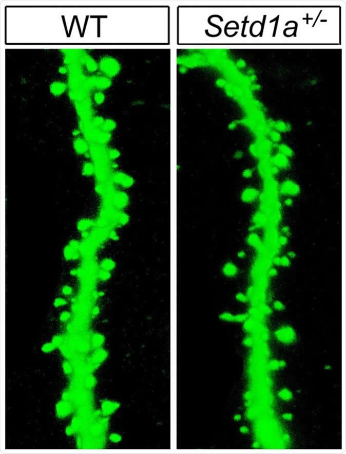 How the SETD1A gene produces schizophrenia in mice