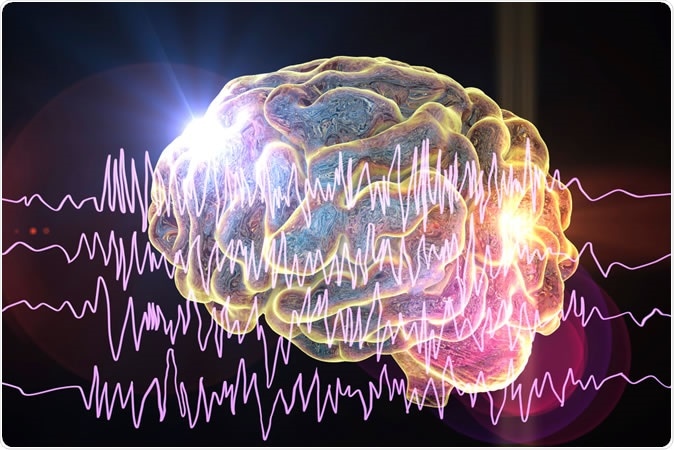Risk of genetic seizure disorder: new scoring system