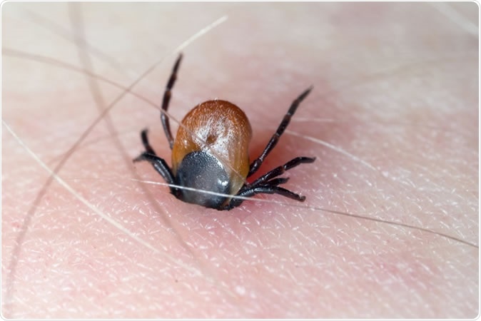 Tick-borne brain infection reported in UK