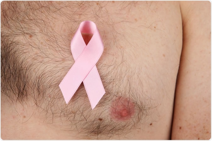 Understanding treatment and prognosis of male breast cancer