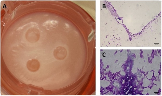 Assessing Wound Dressings on Biofilm Infections