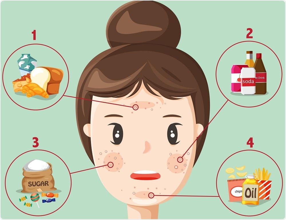 foods that cause acne)