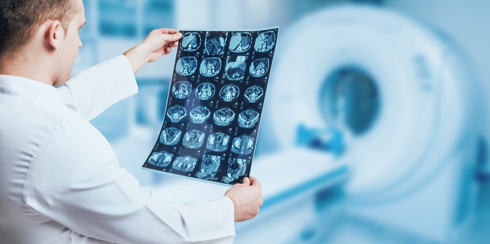 MRI reveals signs of brain damage among obese adolescents