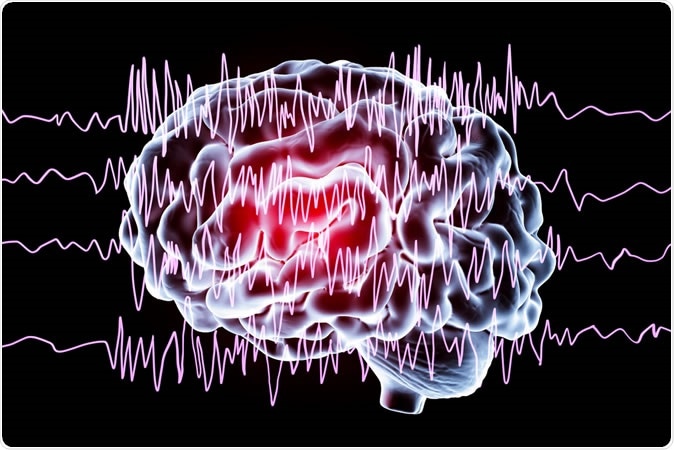 Trial comparing three drugs for status epilepticus