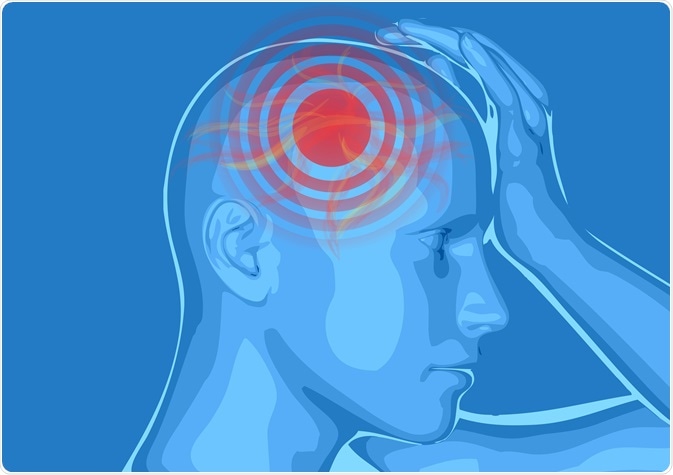 Does the Location of a Headache Matter?