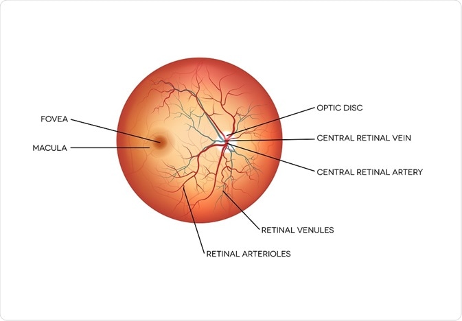 Optic Disc Swelling: Overview