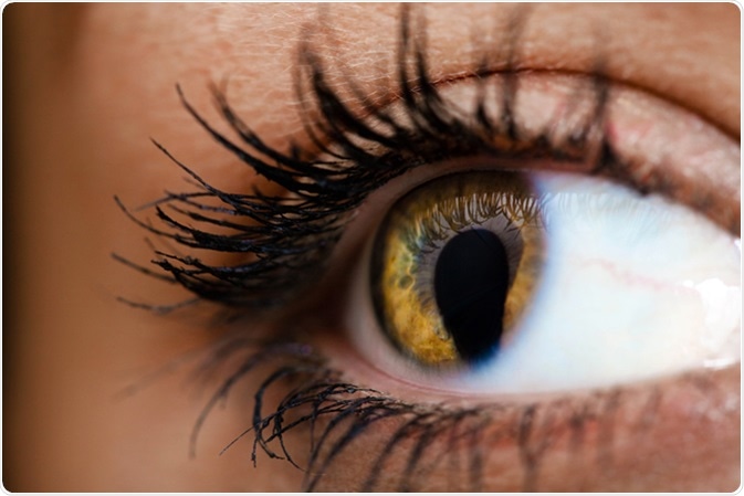 Female eye with Coloboma or cat eye. Image Credit: Shvaygert Ekaterina.