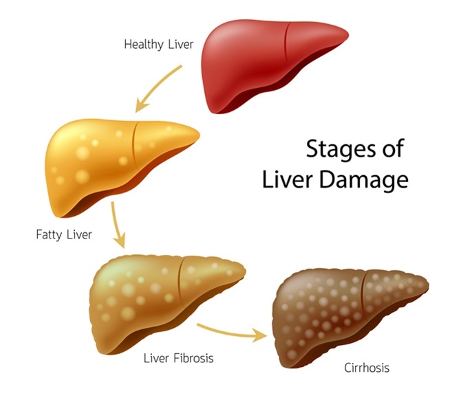 Pancreas Cleanse