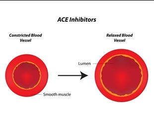 what do ace inhibitors do to blood pressure