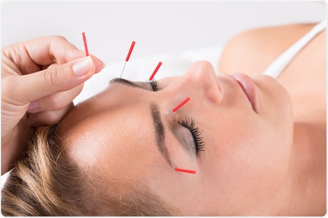 Charlotte Acupuncture Clinic