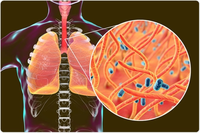 pertussis bacteria