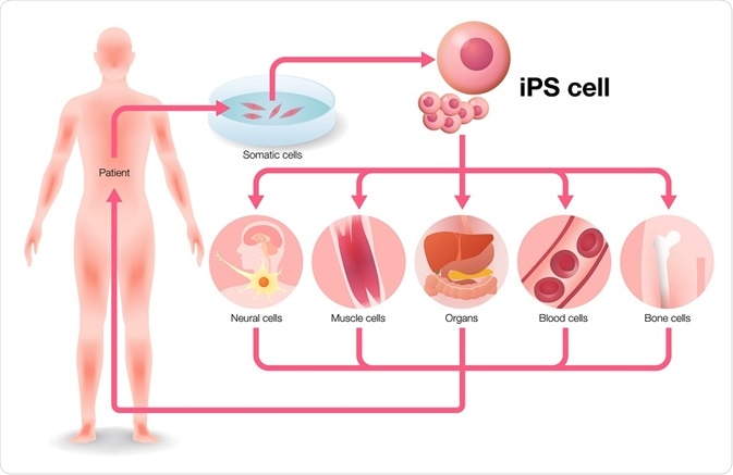 Cellules souche induites de Pluripotent (iPS) dans le médicament et la  recherche