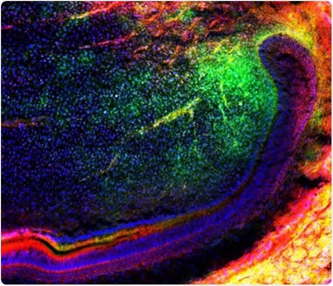 The image shows a group of mesenchymal (green) stem cells migrating in a tooth to further regenerate tissues. Source: Media and Communications | University of Plymouth