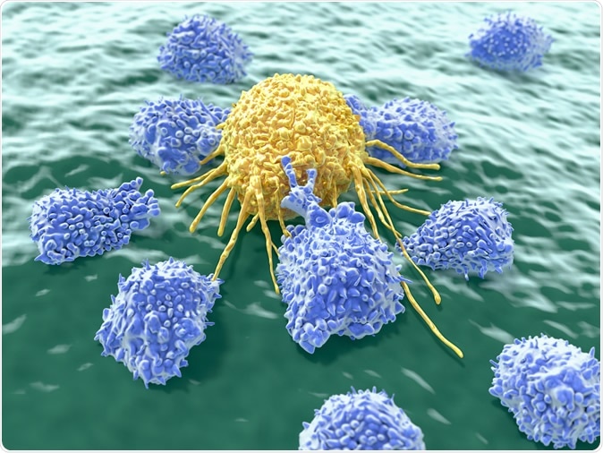 Cancer cell attacked by lymphocytes - Illustration Credit: Juan Gaertner / Shutterstock