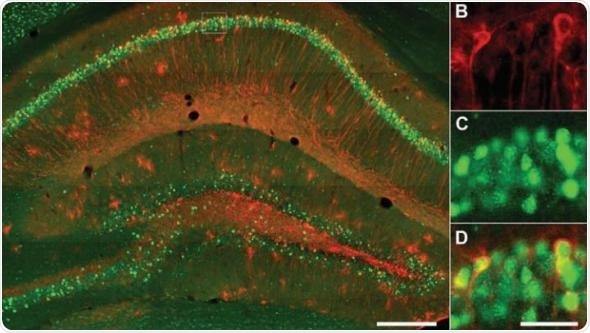 Negative memory hippocampal engrams could underlie cognitive symptoms of depression