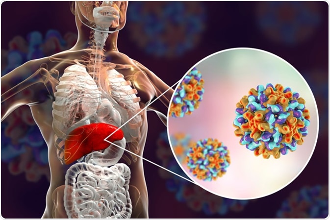 hepatitisz B