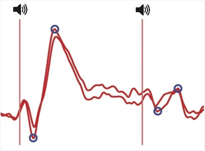 Decreased brain response to the same repeated sound at an interval of half a second (left is sound 1, right is sound 2). Illustration: the responses recorded above the auditory areas of the cortex by means of electroencephalographic electrodes. CREDIT © UNIGE