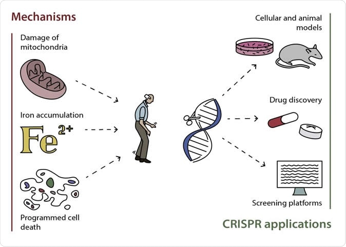 Possible mechanisms of development of Parkinson