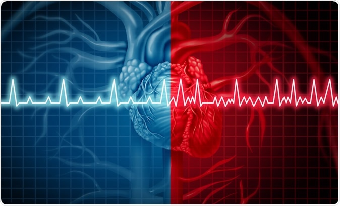 Mobile apps improve atrial fibrillation detection rates in a low-risk population