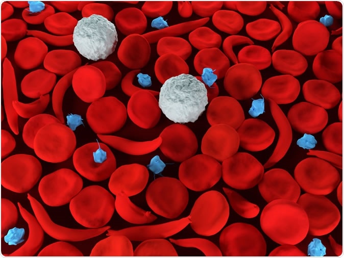 Sickle cell anemia red blood cells