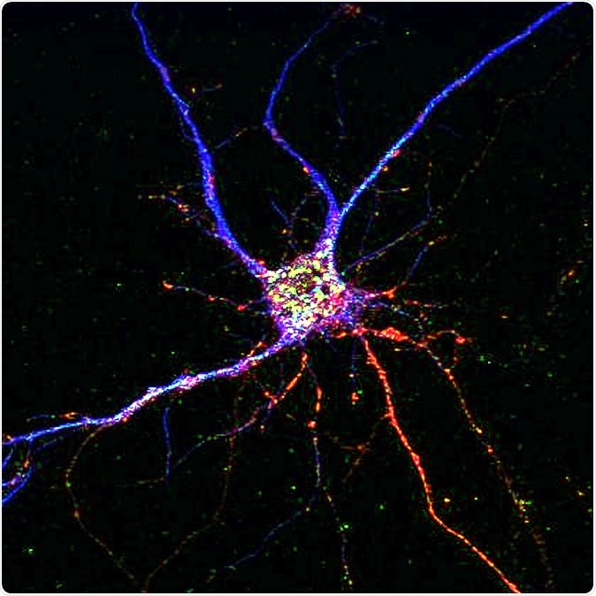 A potential drug target for Alzheimer’s disease has been discovered, affecting both neurons and brain immune cells.