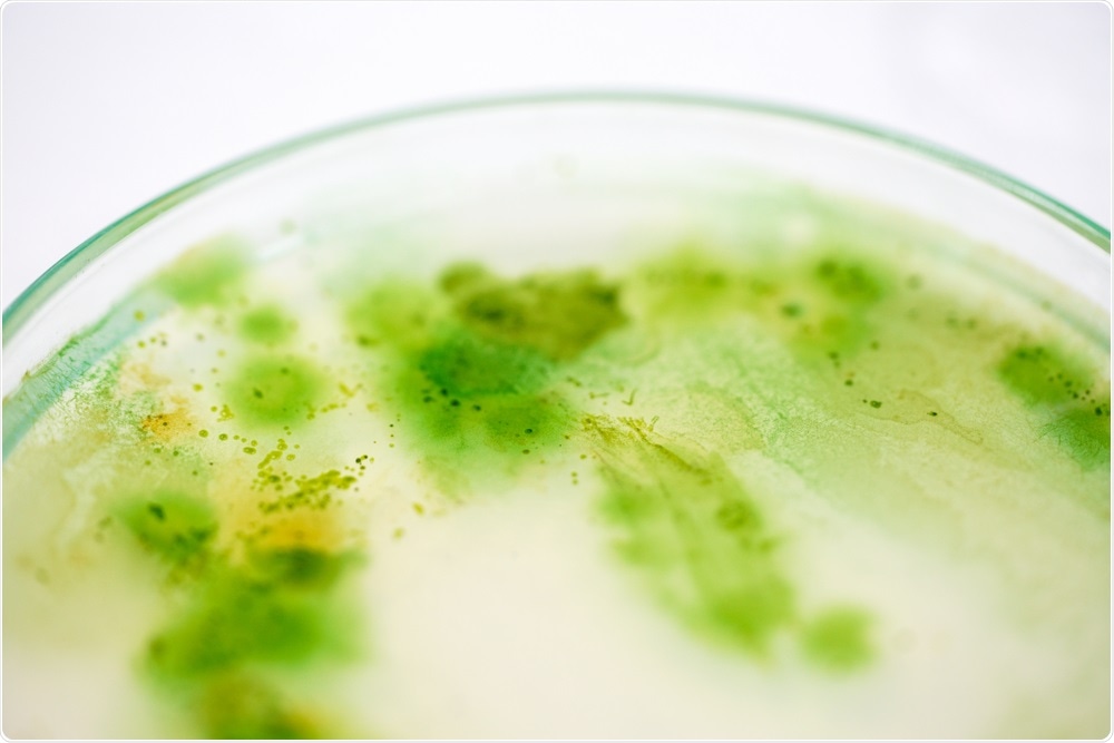 Blue-green algae in petri dish
