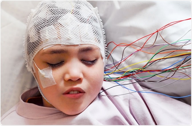 Girl with EEG electrodes attached to her head for medical test Credit: Vasara / Shutterstock