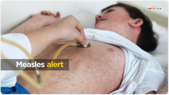 Australians traveling overseas urged to make sure their measles vaccinations are up to date Australians traveling overseas urged to make sure their measles vaccinations are up to date