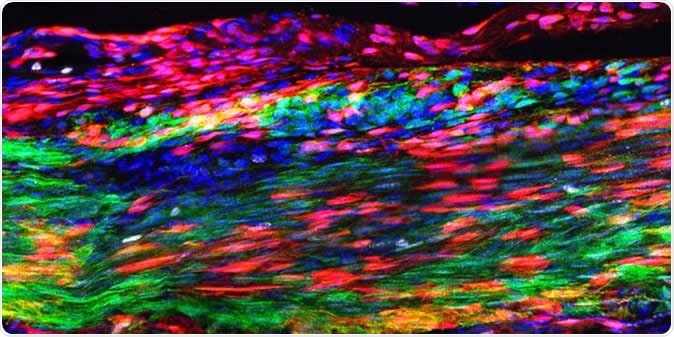 This image shows the Patellar tendon 30 days after an injury. The red marks newly discovered tendon stem cells that have self-renewed and are layered over green marked, original tendon cells. During regeneration, some tendon stem cells differentiate to make newly regenerated tendon cells--a process during which they transition into a yellow-orange color. The blue indicates cellular nuclei. Image Credit: Tyler Harvey