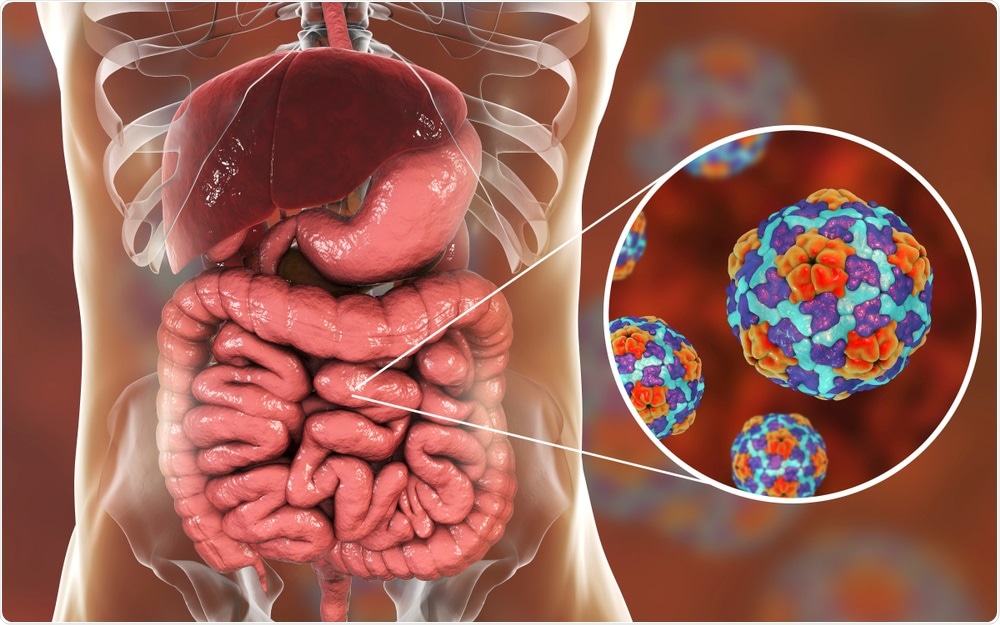 Enterovirus infection - an illustration