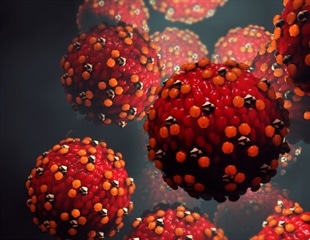 Measles warning in Western Australia