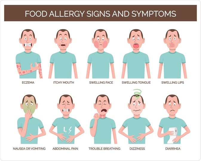 Common symptoms of food allergies.