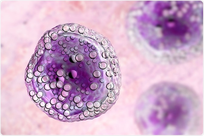 Burkitt's lymphoma cells, is a cancer of the lymphatic system, a monoclonal B-cell tumor, 3D illustration. Image Credit: Kateryna Kon / Shutterstock