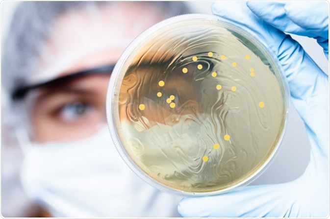Lactobacillus bacteria colonies. Image Credit: NatalieIme / Shutterstock